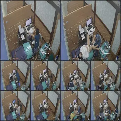 Medical Voyeur Hospital Gynecological Examination