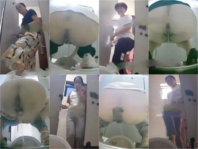 Pregnant super large hemorrhoids 12